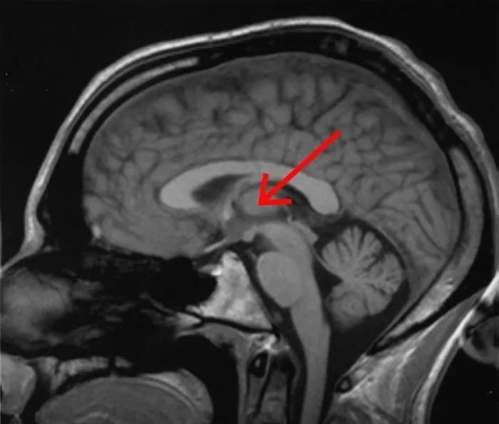 所有粒子都是无意识的，它们堆积起来怎么就形成了有意识的生命？