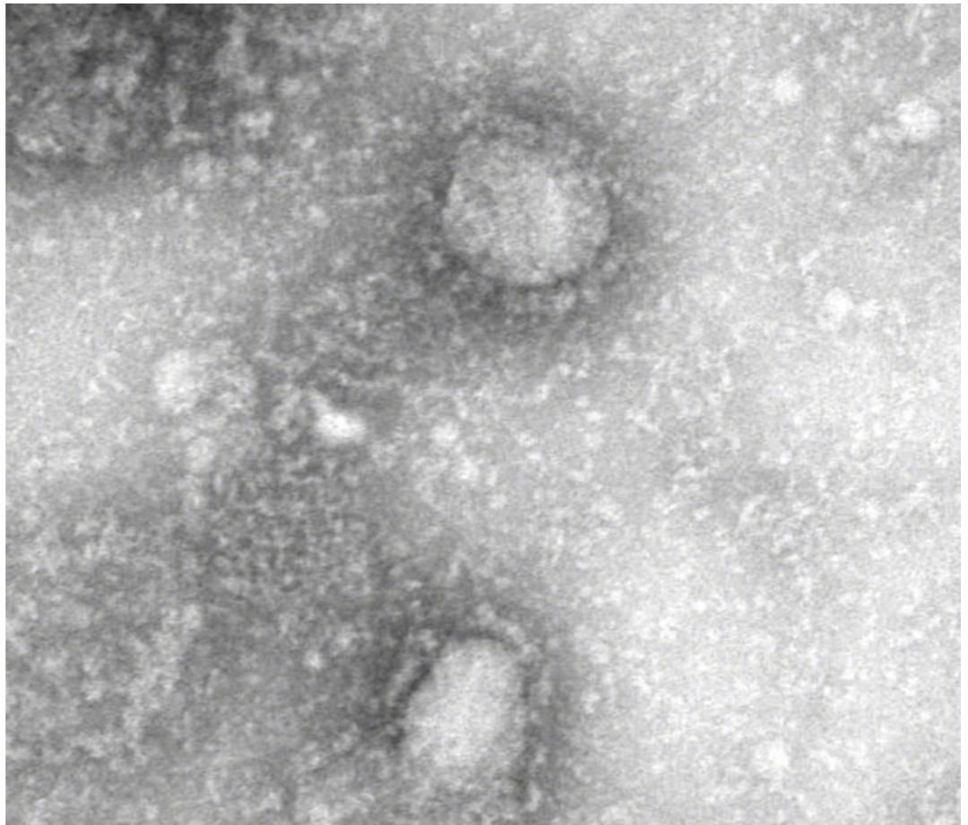 物质波看世界 | 第一话