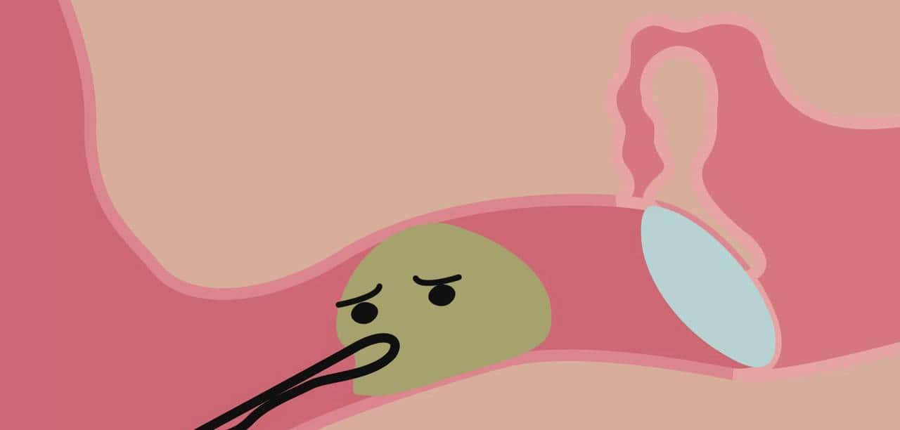 作为人生一大乐趣，频繁掏耳屎真的好吗？