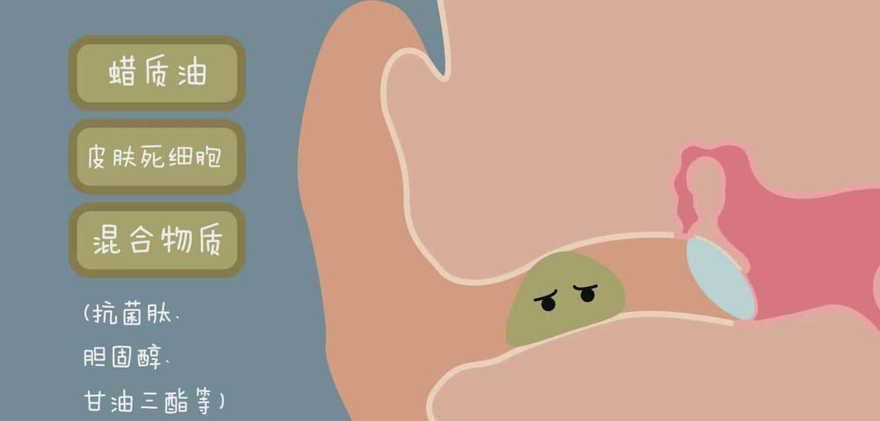 作为人生一大乐趣，频繁掏耳屎真的好吗？