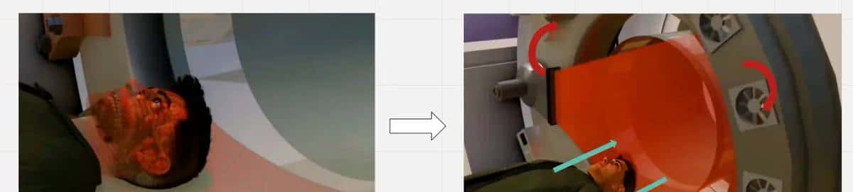 U-Net医学影像分割肝脏CT的肿瘤识别过程及原理解析