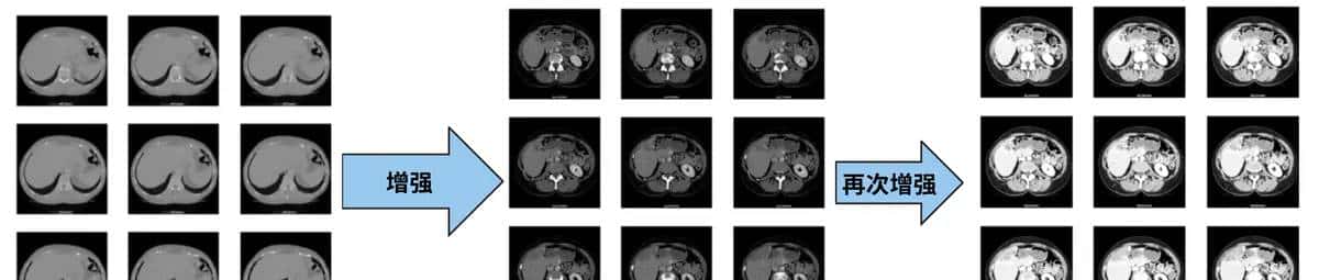 U-Net医学影像分割肝脏CT的肿瘤识别过程及原理解析