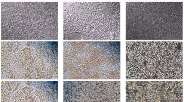 YOLO-Tryppa:一种基于YOLO的新型方法,用于快速精准检测小型锥虫寄生虫