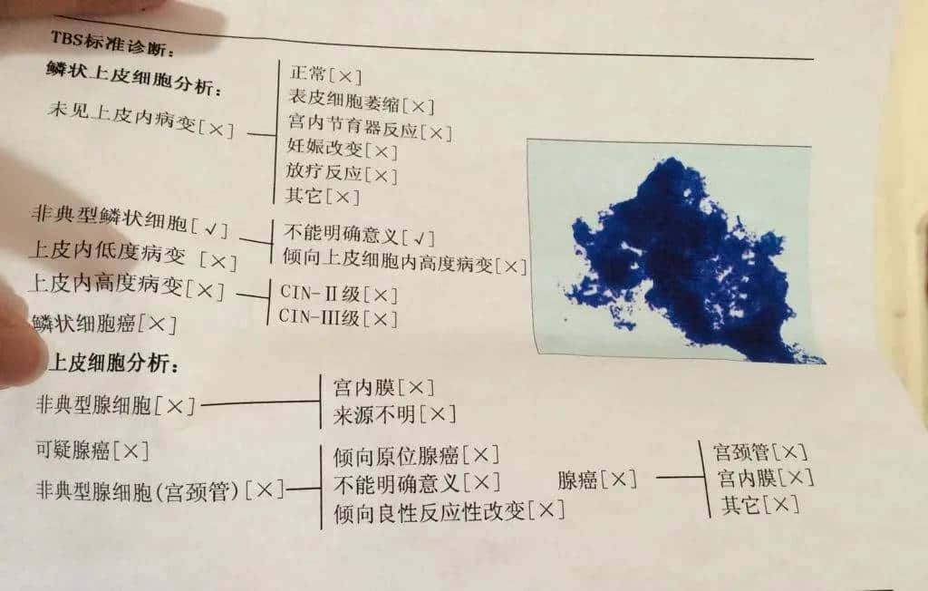 感染hpv后，tct显示ASC-US是什么意思，危险吗