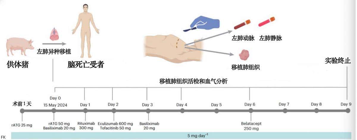 全球首例！除了心、肝、肾，猪的这个器官也成功移植给人