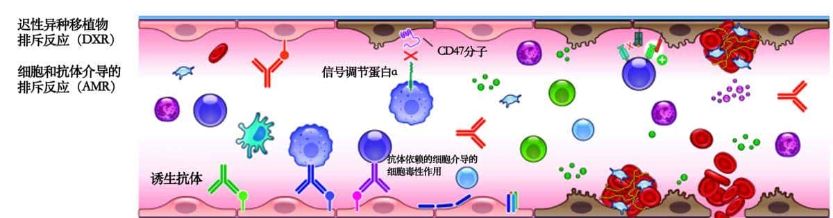 全球首例！除了心、肝、肾，猪的这个器官也成功移植给人